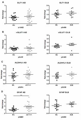 Glutamate Transporter GLT1 Expression in Alzheimer Disease and Dementia With Lewy Bodies